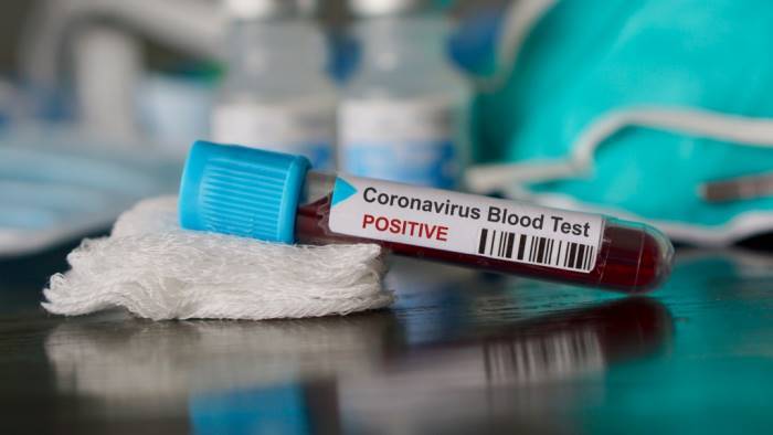 Coronavirus, bollettino dell’11/09/2021: 362 nuovi casi nel Lazio