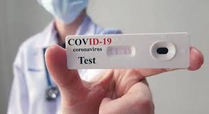 Coronavirus, OK a test sierologici a Polizia Locale di Roma e del Lazio