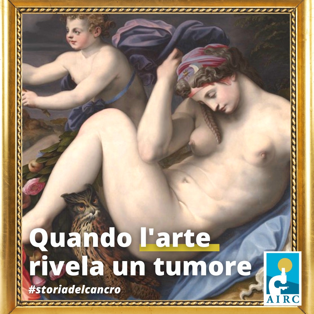 AIRC, Quando l’arte rivela un tumore