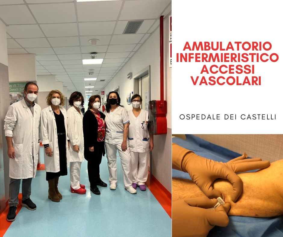 Asl Roma 6, all’ospedale dei Castelli attivo l’ambulatorio infermieristico del Team Accessi Vascolari