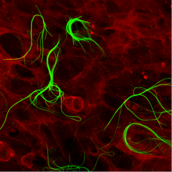 Ricerca: nanomateriali per rigenerare tessuti, italiani aprono nuove prospettive