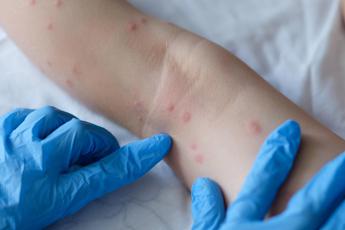 Dermatologi, subito task force per formare medici su Ai